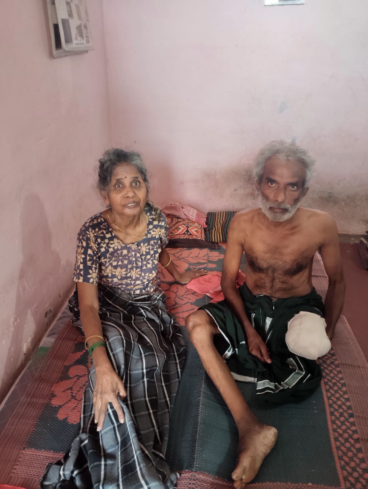 விபத்தில் கால் இழந்த முதியவர் கண்பார்வையற்ற மனைவி கவனிப்பாரற்று தவிக்கும் தம்பதி..